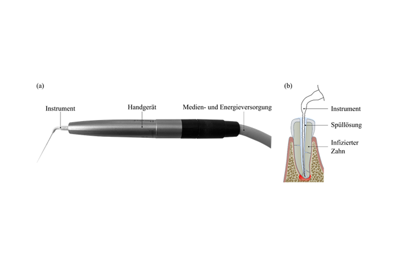 Forschungsgrafik endodontisches Instrument  © Dr.-Ing. Michael Kucher HTWK Leipzig